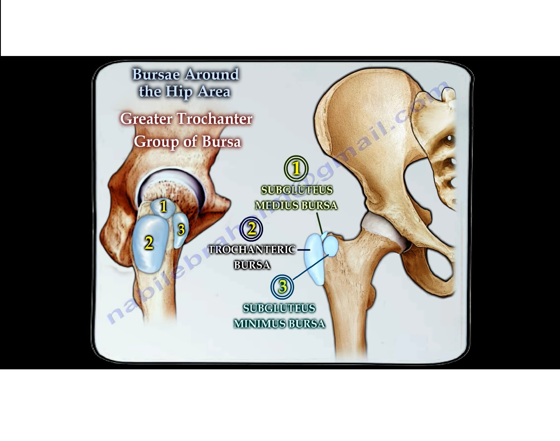 Bursitis Around The Hip Orthopaedicprinciples