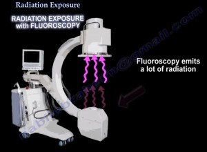 Fluoroscopy