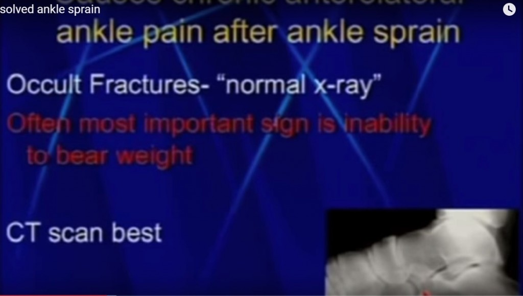 unresolved ankle sprain