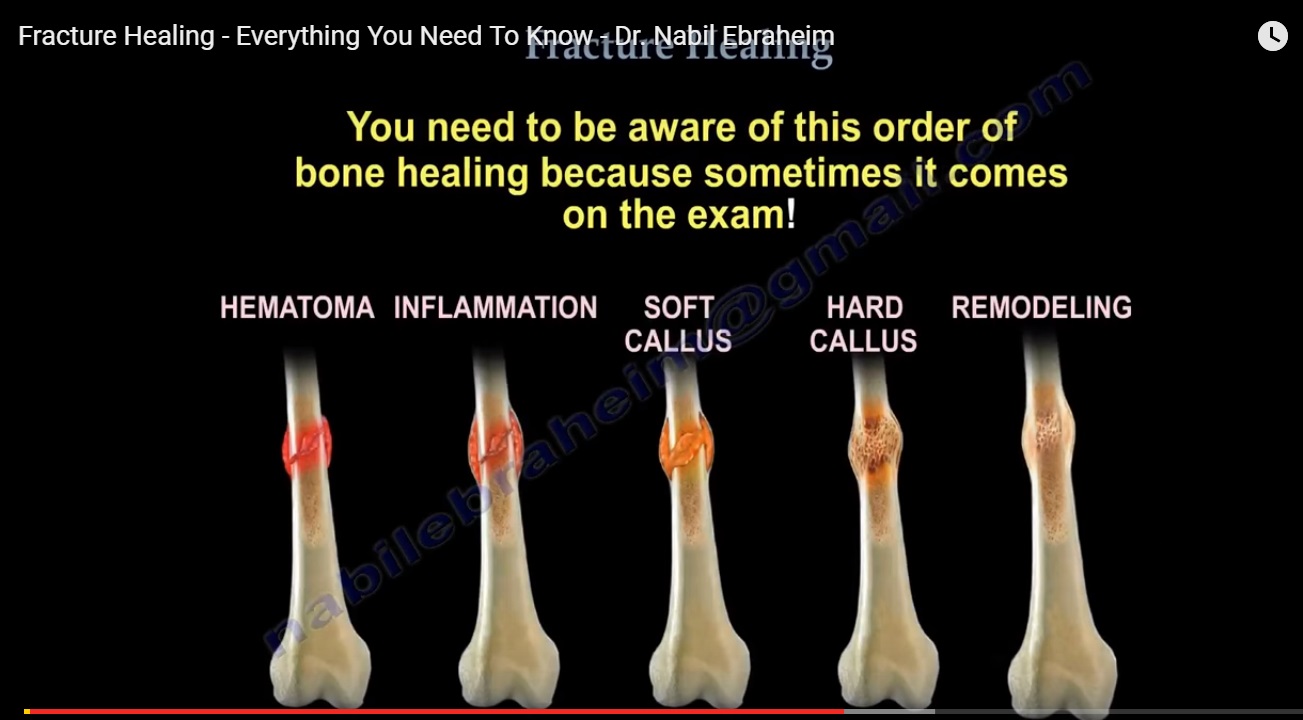 Principles of Fracture healing —