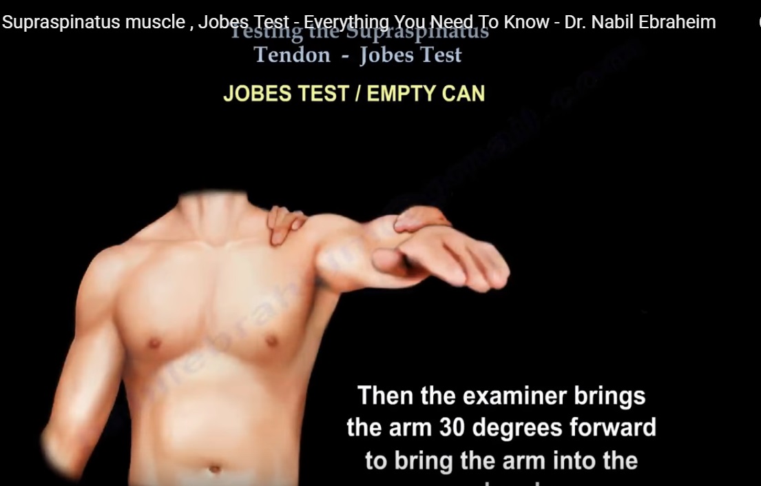 Image result for jobe test for shoulder