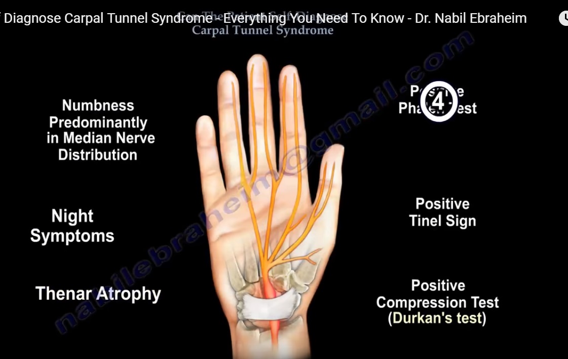 http://orthopaedicprinciples.com/wp-content/uploads/2018/01/Signs-and-symptoms-of-Carpal-Tunnel-Syndrome.jpg