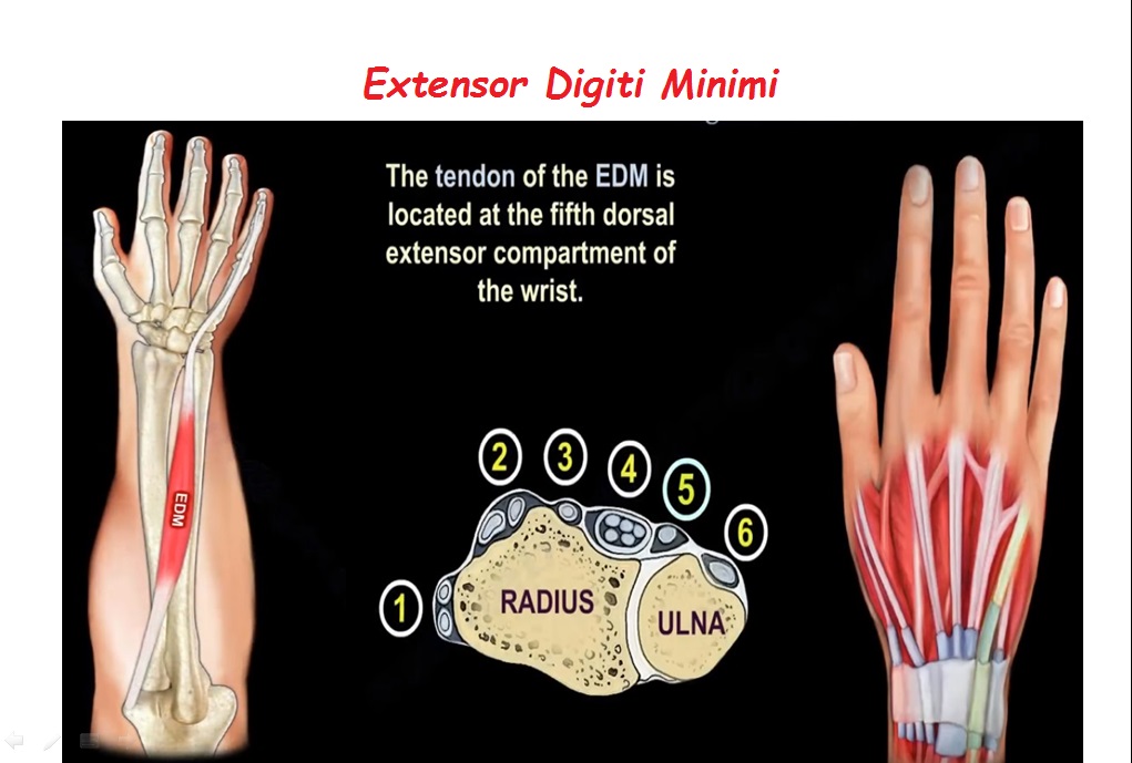 extensor digiti minimi muscle