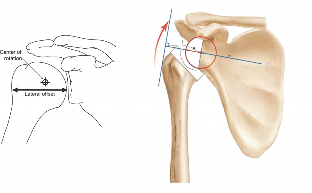 Reverse shoulder arthroplasty orthopaedicprinciples