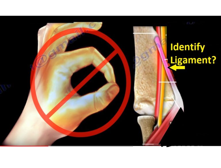 Median Nerve Compression at the Elbow — OrthopaedicPrinciples.com