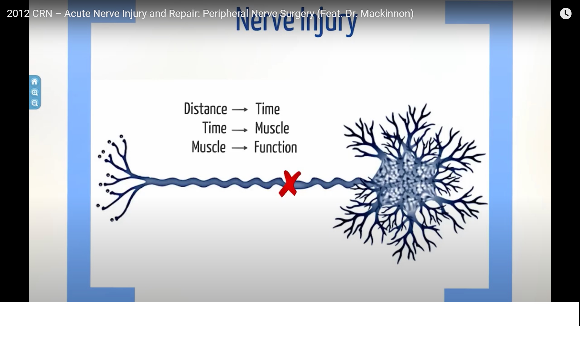 Acute Nerve Injury And Nerve Repair — OrthopaedicPrinciplescom