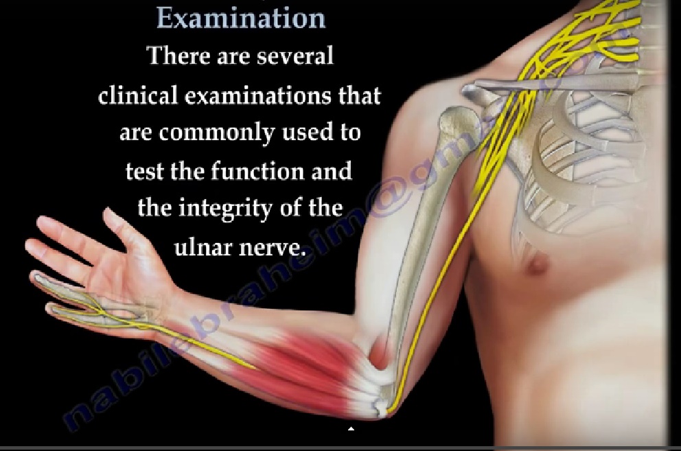 How long are you off work for ulnar nerve surgery?