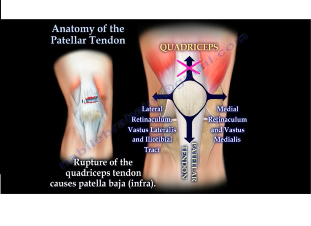 Anatomy of the Patellar Tendon — OrthopaedicPrinciples.com