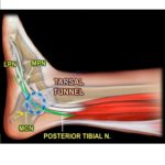 Lateral Plantar Nerve- Anatomy — OrthopaedicPrinciples.com