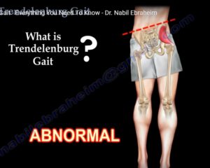 Trendelenburg Test/Gait — OrthopaedicPrinciples.com