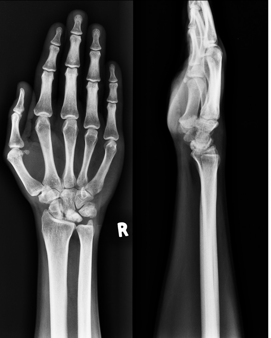 Image Quiz 10 #Wrist — OrthopaedicPrinciples.com