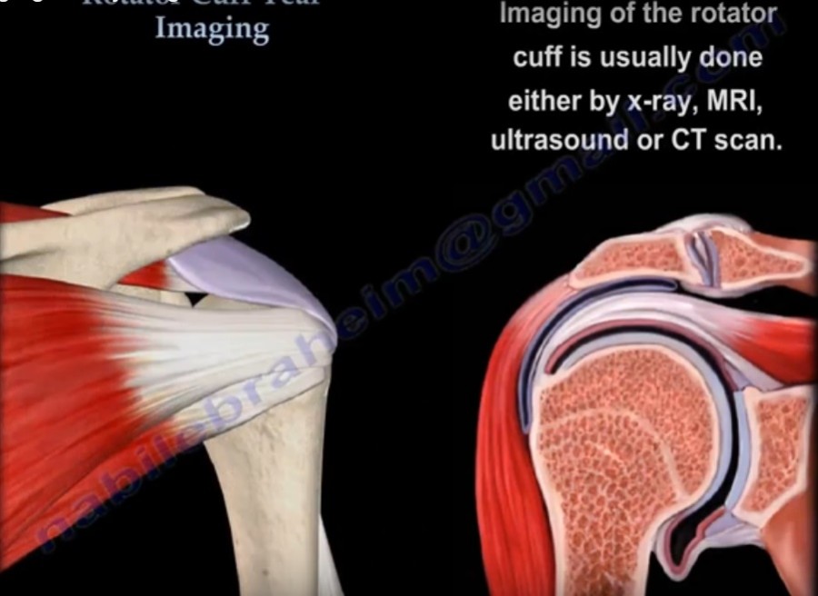 Rotator Cuff Imaging — OrthopaedicPrinciples.com