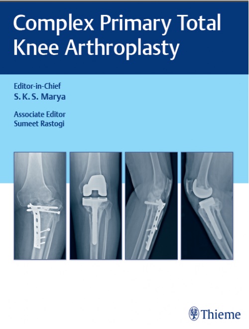 thesis of knee arthroplasty