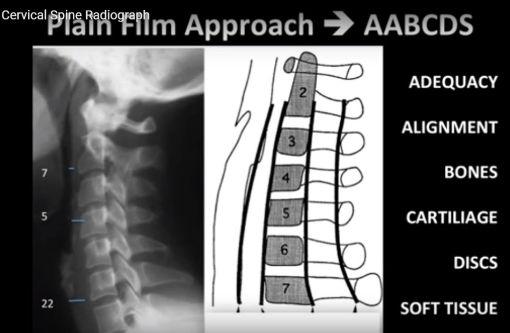 cpt code for x ray cervical spine