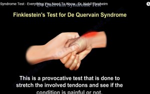 Finkelstein’s test — OrthopaedicPrinciples.com