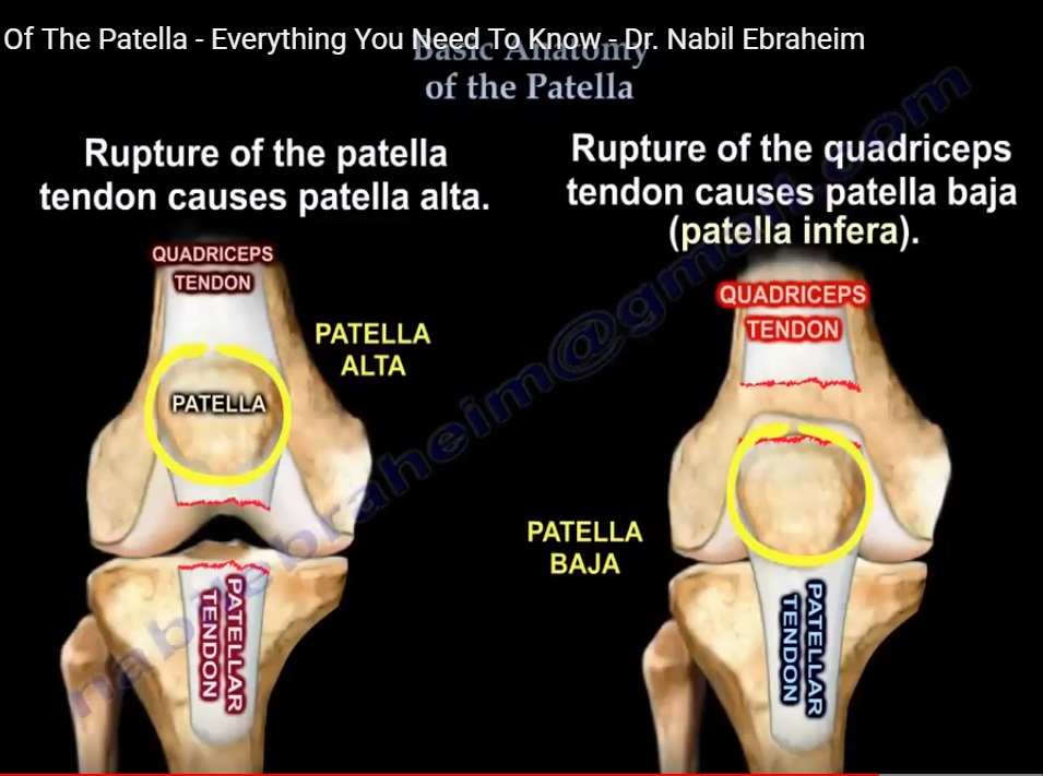 Anatomy and Biomechanics of the Patella — OrthopaedicPrinciples.com