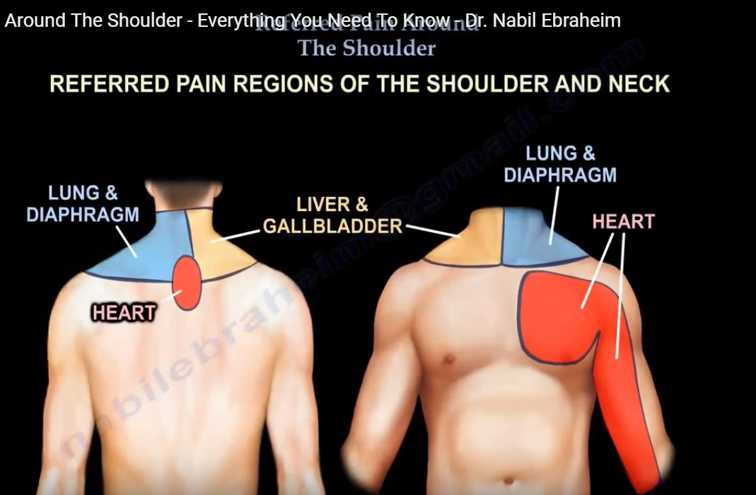 Referred Pain Around The Shoulder OrthopaedicPrinciples