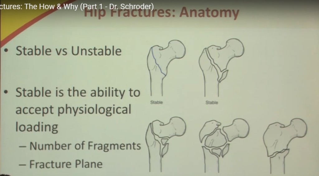 Hip Fracture Types