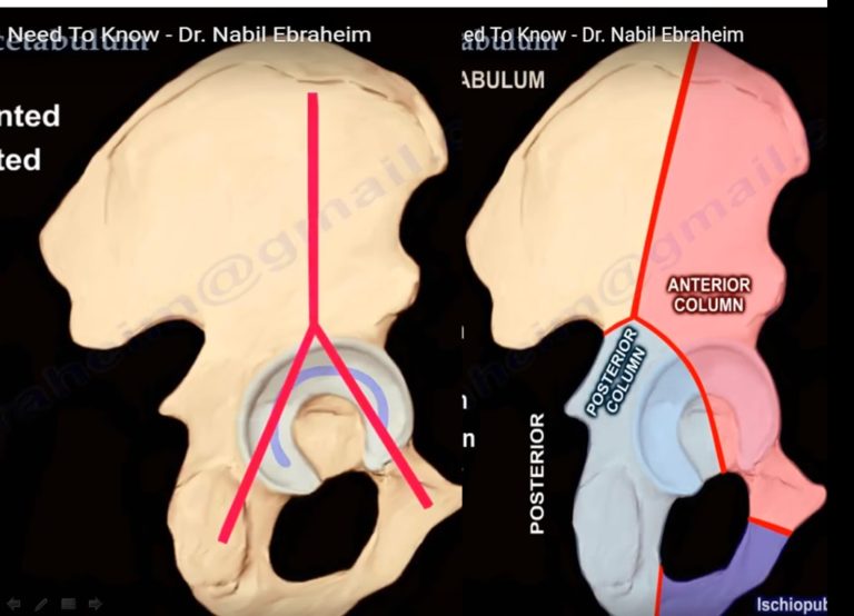 Anatomy Of The Acetabulum — OrthopaedicPrinciples.com