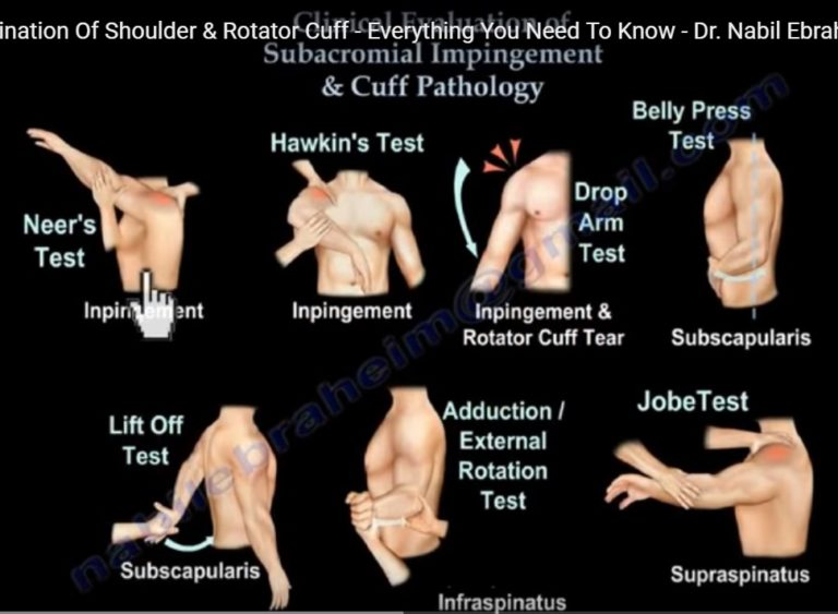 clinical-examination-of-shoulder-and-rotator-cuff
