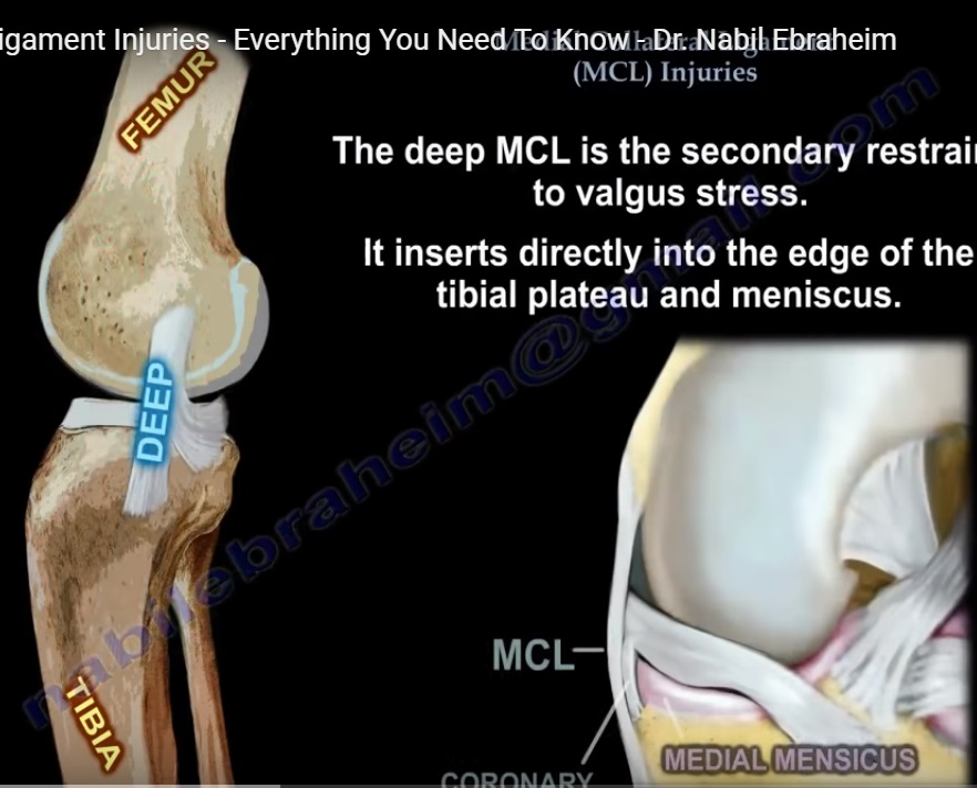 Medial Collateral Ligament Injuries — OrthopaedicPrinciples.com
