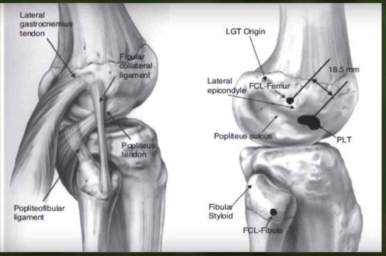 Pld Knuckle PCL & PLC Injuries — OrthopaedicPrinciples.com