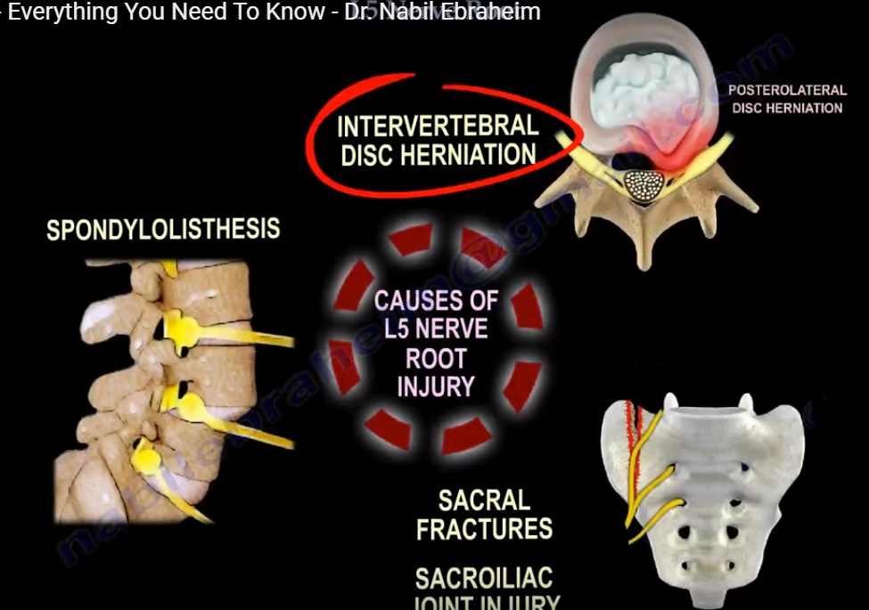 Ulnar Nerve, Clinical Examination - Everything You Need To Know - Dr. Nabil  Ebraheim 