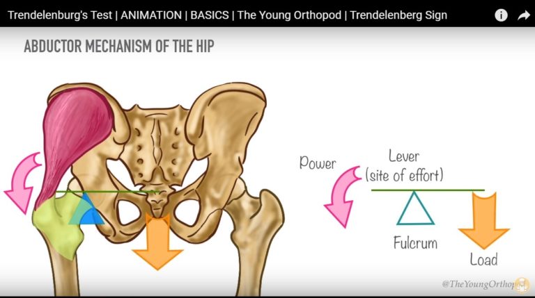 Trendelenburg test — OrthopaedicPrinciples.com