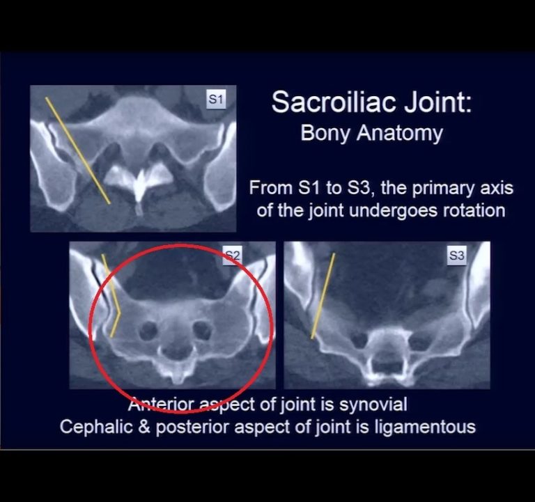 Anatomy 101 Understanding Your Sacroiliac Joint | Images and Photos finder