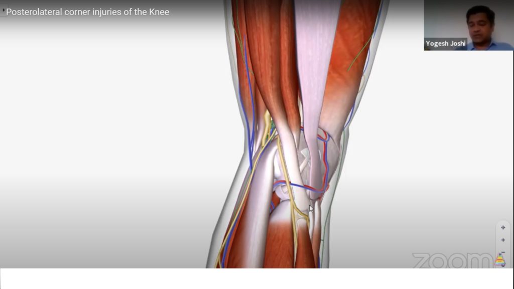 Posterolateral corner injuries of the Knee — OrthopaedicPrinciples.com