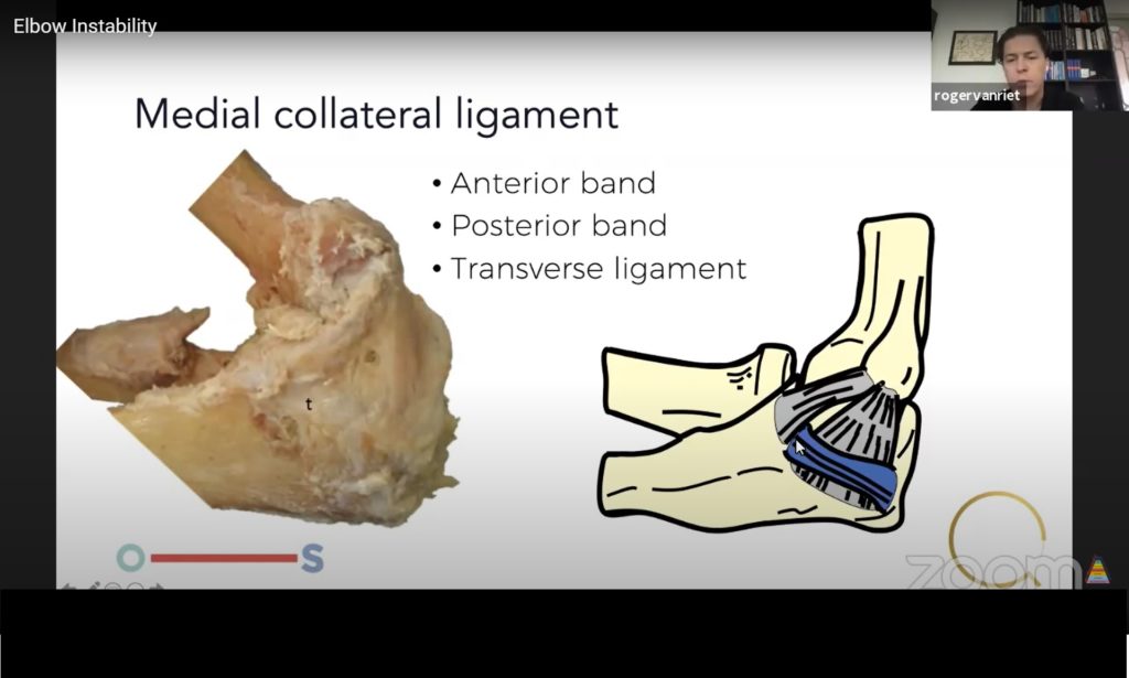 Elbow Instability — OrthopaedicPrinciples.com