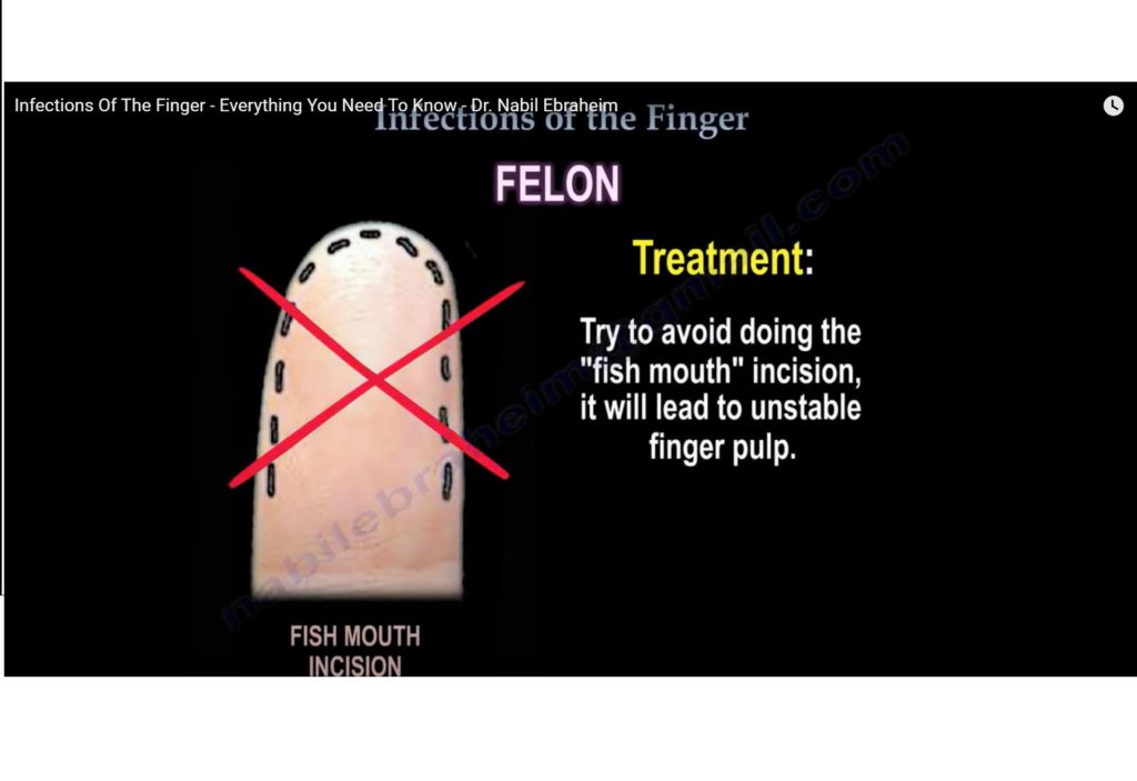 Infections of the Finger —