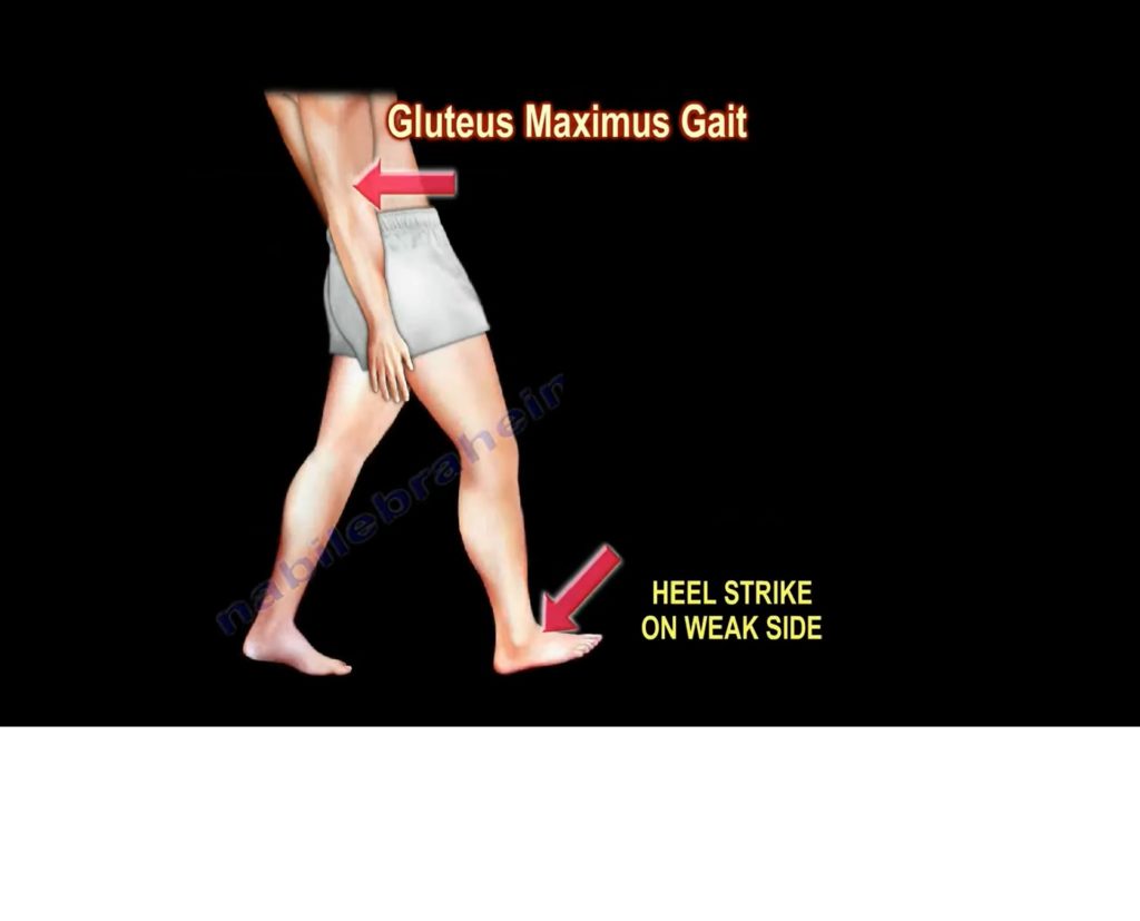 gluteus-maximus-gait-orthopaedicprinciples