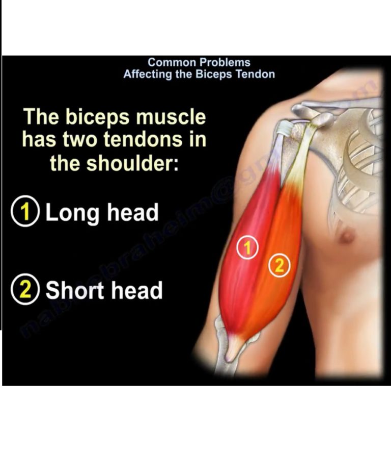 Biceps Tendon Pathologies — 3764