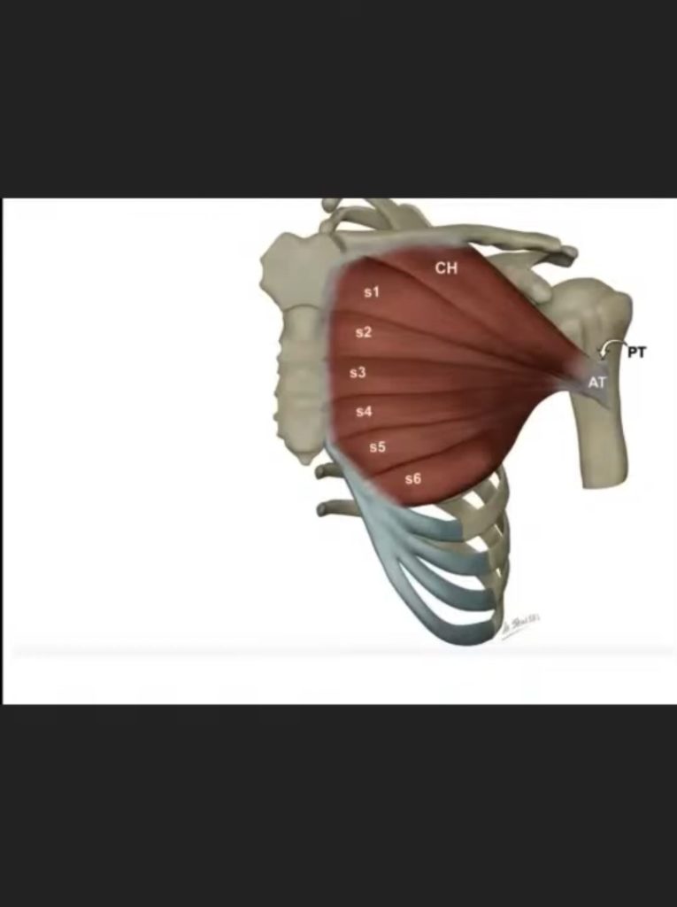 Pectoralis Major Tendon Tear 5130