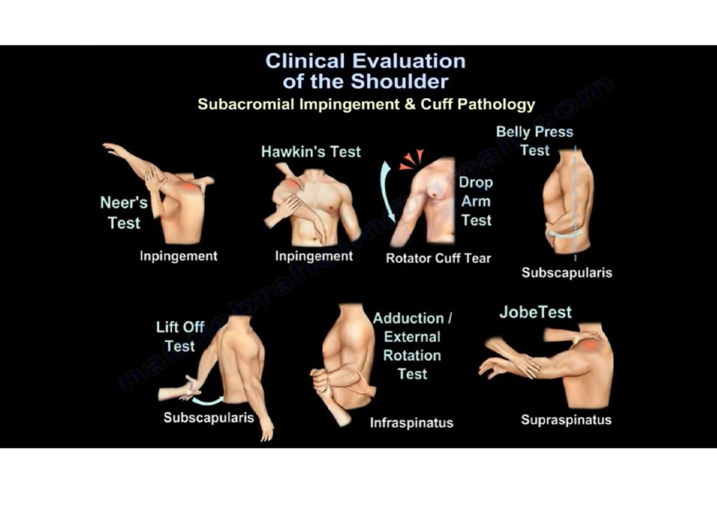 Shoulder Diagnosis Chart