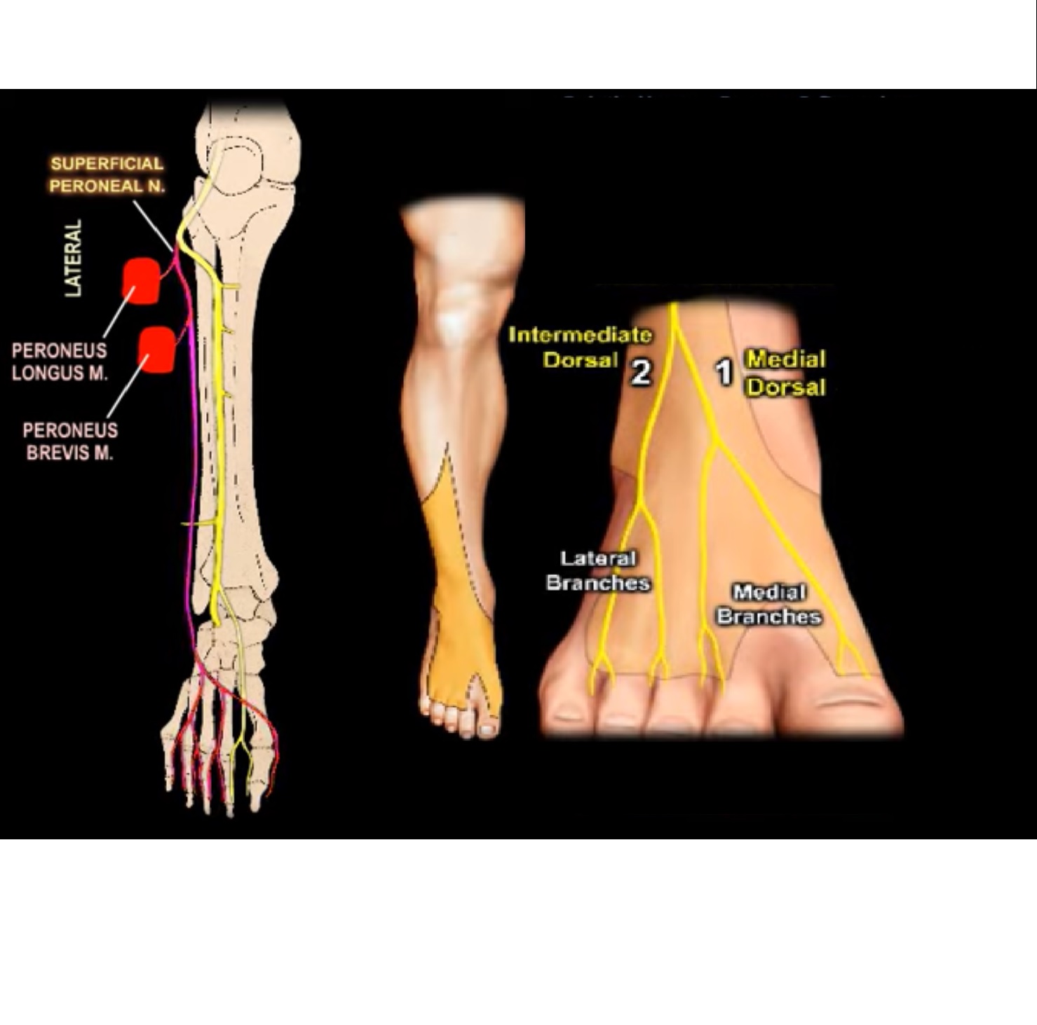 What part of the foot does the sciatic nerve affect?