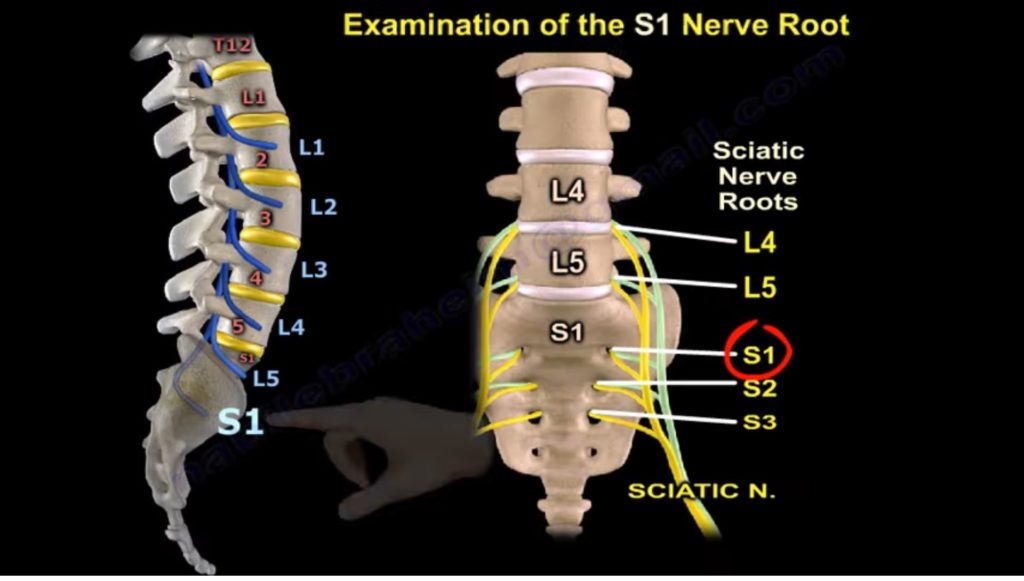 examination-of-s1-nerve-root-orthopaedicprinciples