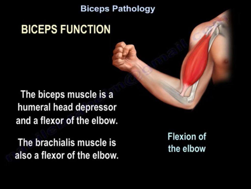 Common Pathologies Of The Biceps Tendon — OrthopaedicPrinciples.com