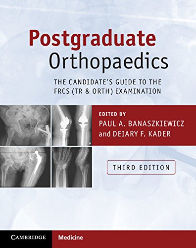 Postgraduate Orthopaedics: The Candidate’s Guide to the FRCS(Tr & Orth ...