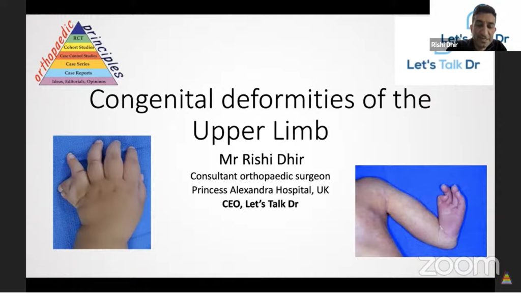 Congenital deformities of the Upper Limb — OrthopaedicPrinciples.com