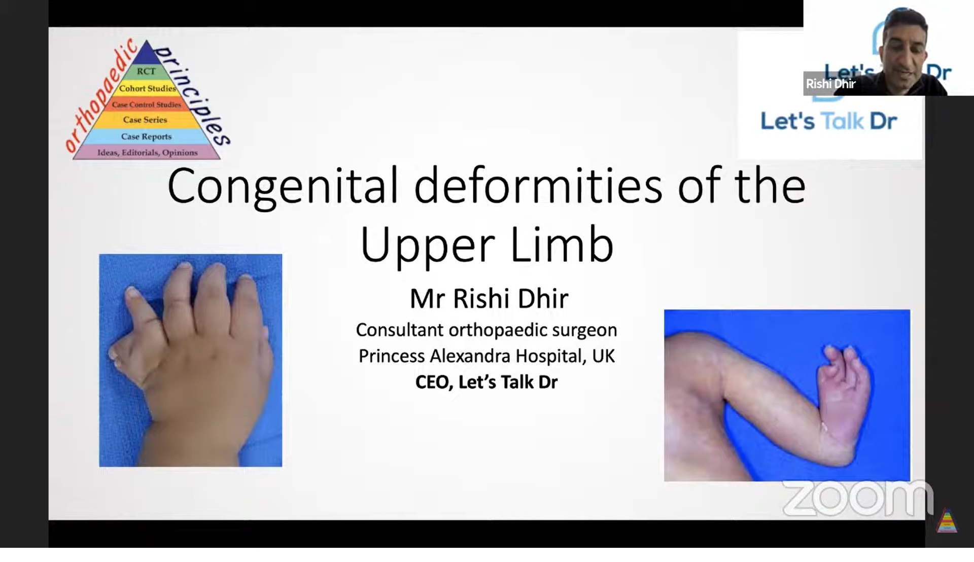 congenital-deformities-of-the-upper-limb-orthopaedicprinciples