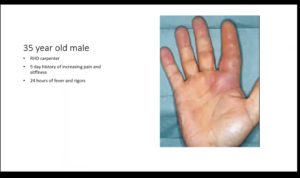 Upper Limb Trauma Case Studies- London Hand and Wrist Course ...