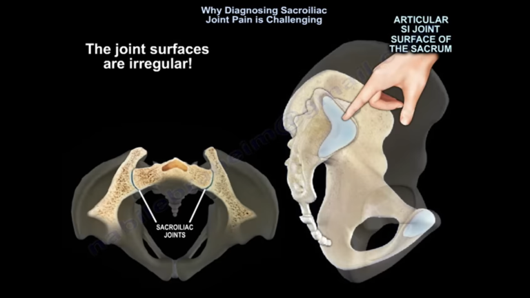 Sacroiliac Joint Pain Diagnosis — OrthopaedicPrinciples.com