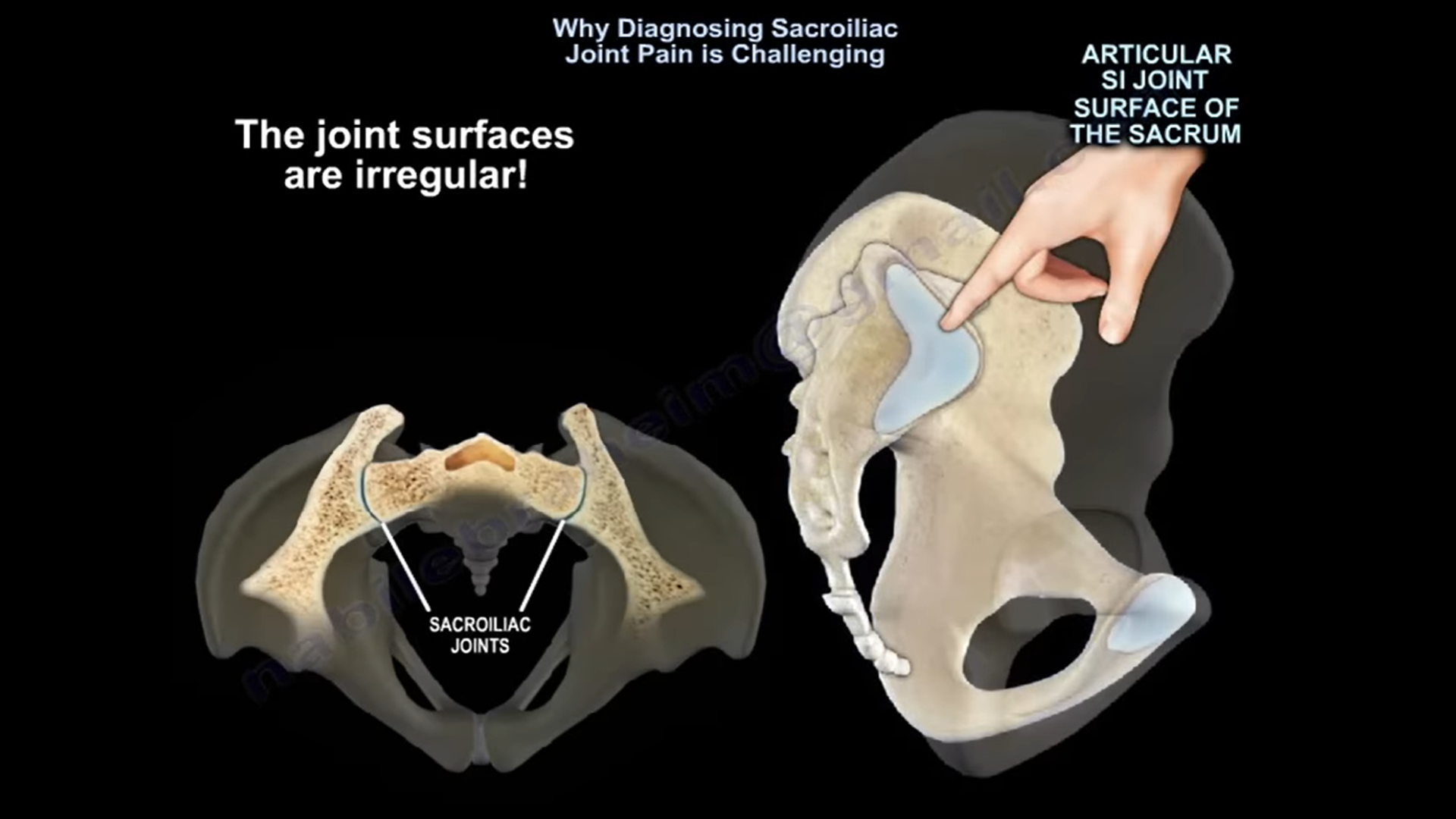 Sacroiliac Joint Palpation