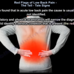 LOW BACK PAIN: Causes, Diagnosis and Treatment