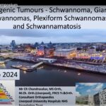 Liverpool Ortho Oncology Symposium: Neurofibromas, Schwannomas
