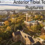 Anterior Tibial Tendon Tears